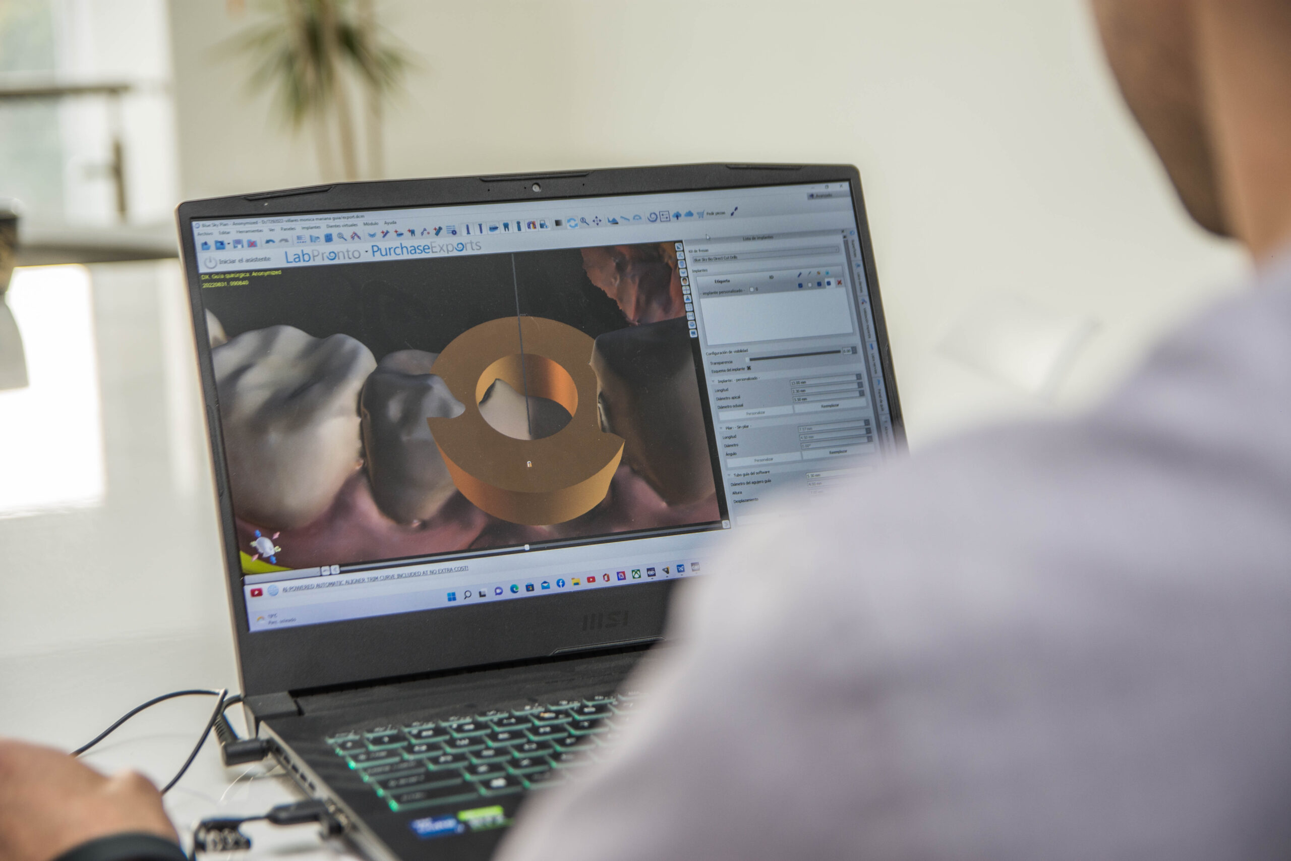 Software de planificación mostrando el modelo dental en 3D